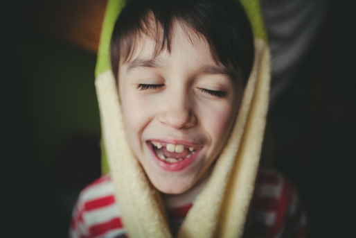 Kid with Congenitally Missing teeth