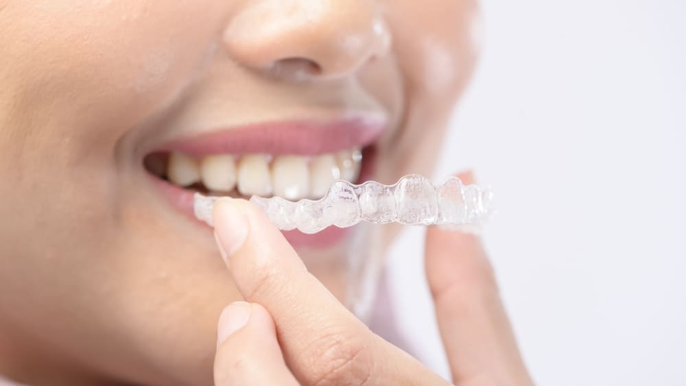 11 Ways to Get the Most Out of Your Invisalign Treatment