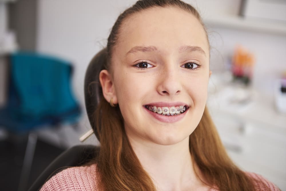 Can Invisalign Fix Overbite - Thurman Orthodontics