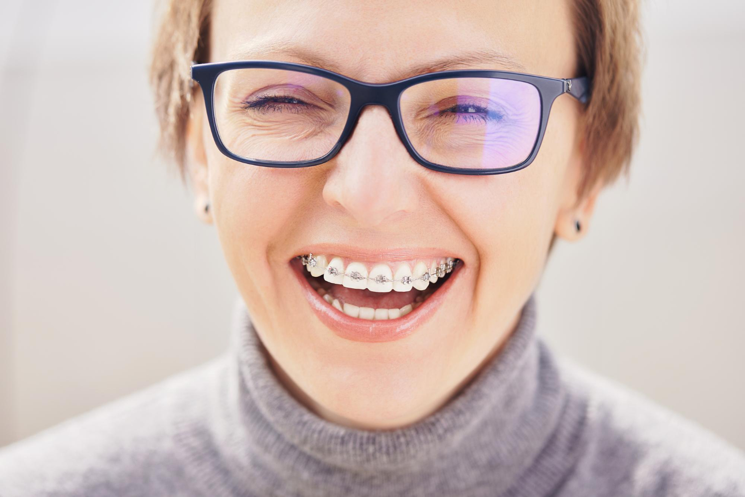 Can Invisalign Fix Overbite - Thurman Orthodontics